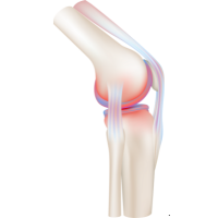 Knee Replacement at Dr Mittal's rehab